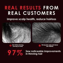 Cargar imagen en el visor de la galería, The Revive Scalp Brush by LuxeBath™
